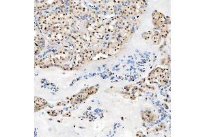 IHC analysis of U1-C/SNRPC using anti-U1-C/SNRPC antibody (ABIN7599016).