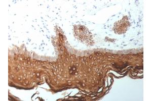 Formalin-fixed, paraffin-embedded human Skin stained with Cytokeratin, 5/6/18 Mouse Monoclonal Antibody (SPM267). (Keratin 5,6,18 Antikörper)