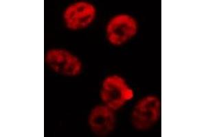 Immunofluorescence (fixed cells) (IF/ICC) image for anti-RNA Binding Motif Protein, X-Linked (RBMX) (N-Term) antibody (ABIN6262320)