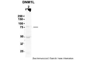 Sample Type: 2. (Dynamin 1-Like Antikörper  (N-Term))