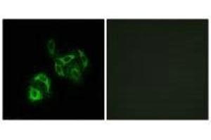 Immunofluorescence analysis of A549 cells, using SLC27A4 antibody. (SLC27A4 Antikörper)