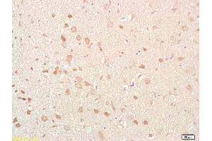 Formalin-fixed and paraffin embedded rat brain labeled with Anti-NKB Polyclonal Antibody, Unconjugated (ABIN724460) at 1:200 followed by conjugation to the secondary antibody and DAB staining