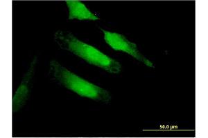 Immunofluorescence of monoclonal antibody to CA10 on HeLa cell.