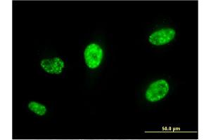 Immunofluorescence of monoclonal antibody to PCGF5 on HeLa cell. (PCGF5 Antikörper  (AA 51-148))