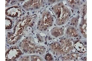 Image no. 4 for anti-V-Akt Murine Thymoma Viral Oncogene Homolog 1 (AKT1) antibody (ABIN1496556) (AKT1 Antikörper)