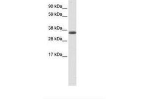 Image no. 1 for anti-Excision Repair Cross-Complementing Rodent Repair Deficiency, Complementation Group 8 (ERCC8) (AA 37-86) antibody (ABIN6736089) (ERCC8 Antikörper  (AA 37-86))