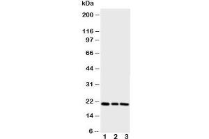 Western blot testing of PBP antibody and Lane 1:  rat brain;  2: (r) lung;  3: (r) liver (PEBP1 Antikörper  (N-Term))