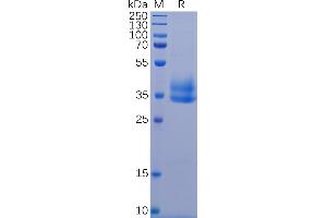 Human IL2RB Protein, His Tag on SDS-PAGE under reducing condition.