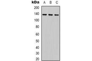 Western blot analysis of HER2 expression in HEK293T (A), 22RV1 (B), Hela (C) whole cell lysates. (ErbB2/Her2 Antikörper)