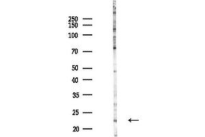 anti-Sclerostin Domain Containing 1 (SOSTDC1) antibody