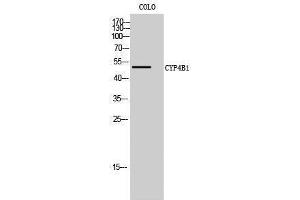 Western Blotting (WB) image for anti-Cytochrome P450, Family 4, Subfamily B, Polypeptide 1 (CYP4B1) (Internal Region) antibody (ABIN3174667) (CYP4B1 Antikörper  (Internal Region))