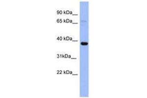 Image no. 1 for anti-Immediate Early Response 5 (IER5) (N-Term) antibody (ABIN6741712) (IER5 Antikörper  (N-Term))