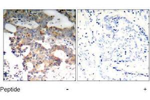 Image no. 1 for anti-Nuclear Factor of kappa Light Polypeptide Gene Enhancer in B-Cells Inhibitor, epsilon (NFKBIE) (Ser22) antibody (ABIN197570) (NFKBIE Antikörper  (Ser22))