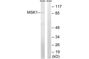 Western blot analysis of extracts from mouse brain cells, using MSK1 (epitope around residue 212) antibody. (MSK1 Antikörper  (Ser212))