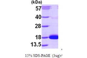 SDS-PAGE (SDS) image for Cytidine Deaminase (CDA) (AA 1-146) protein (His tag) (ABIN667230) (CDA Protein (AA 1-146) (His tag))