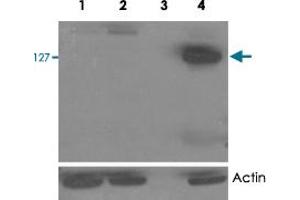HEK293 overexpressing TANK2 (lane 4) and TANK1 (lane 2) and probed with TNKS2 polyclonal antibody  (mock transfection in first lane).