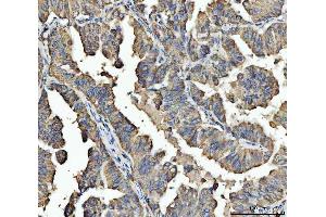 IHC analysis of ARL13B using anti-ARL13B antibody (ABIN7600179). (ARL13B Antikörper  (AA 16-428))