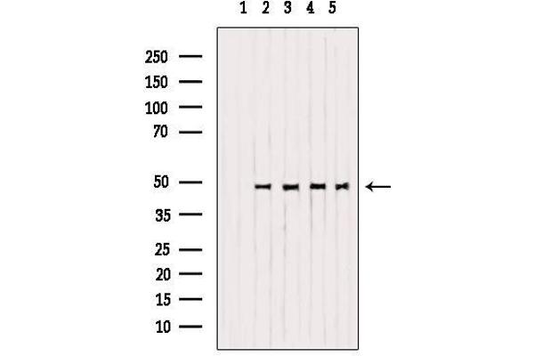 Mu Opioid Receptor 1 Antikörper  (C-Term)