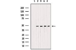 Western blot analysis of extracts from various samples, using OPRM1 Antibody. (Mu Opioid Receptor 1 Antikörper  (C-Term))