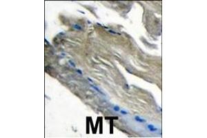 Formalin-fixed and paraffin-embedded human muscle tissue tissue reacted with PI3CKG antibody (C-term) (ABIN392816 and ABIN2842247) , which was peroxidase-conjugated to the secondary antibody, followed by DAB staining. (PIK3 gamma Antikörper  (C-Term))