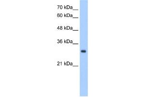 WB Suggested Anti-NPDC1 Antibody Titration:  2. (NPDC1 Antikörper  (N-Term))