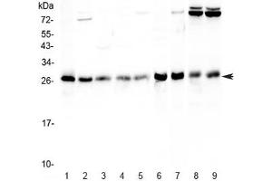 Western blot testing of human 1) HeLa, 2) Jurkat, 3) MCF7, 4) HepG2, 5) A549, 6) rat stomach, 7) rat thymus, 8) mouse thymus and 9) mouse NIH3T3 lysate with RAB27A antibody at 0. (RAB27A Antikörper)