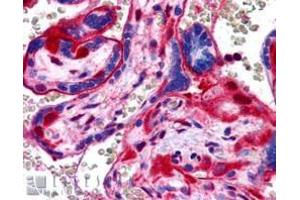 Image no. 1 for anti-Annexin A11 (ANXA11) (N-Term) antibody (ABIN374162) (Annexin A11 Antikörper  (N-Term))