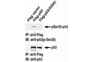 Western Blotting (WB) image for anti-Tumor Protein P53 (TP53) (pSer20) antibody (ABIN1449251) (p53 Antikörper  (pSer20))