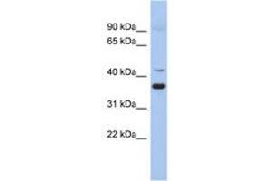 Image no. 1 for anti-Glutamate Decarboxylase-Like 1 (GADL1) (AA 215-264) antibody (ABIN6743948) (GADL1 Antikörper  (AA 215-264))