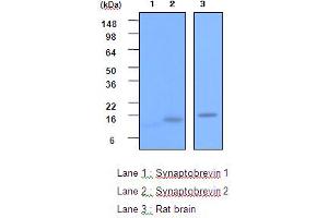 Western blot analysis: Lane 1 : Synaptobrevin 1 Lane 2 : Synaptobrevin 2 Lane 3 : Rat brain.