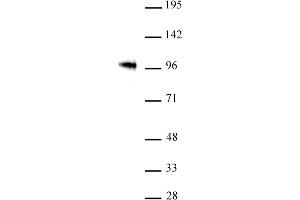 SOX6 antibody (pAb) tested by Western blot. (SOX6 Antikörper  (AA 1-20))