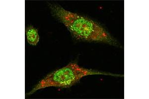 Confocal immunofluorescence analysis of Eca-109 cells using ERK2 mouse mAb (green). (ERK2 Antikörper)