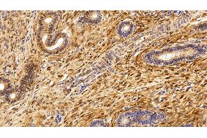Immunohistochemistry (IHC) image for anti-S100 Calcium Binding Protein A6 (S100A6) (AA 1-90) antibody (ABIN7434041)