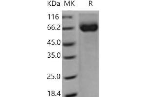 Western Blotting (WB) image for CD226 (CD226) (Active) protein (Fc Tag) (ABIN7321104) (CD226 Protein (CD226) (Fc Tag))