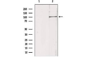 Western blot analysis of extracts from 293, using RBM15 antibody. (RBM15 Antikörper  (N-Term))