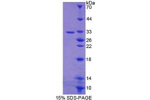 Image no. 1 for ATP-Binding Cassette, Sub-Family B (MDR/TAP), Member 9 (ABCB9) (AA 500-762) protein (T7 tag,His tag) (ABIN6239296)