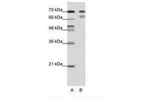 Image no. 1 for anti-Transcription Factor 3 (E2A Immunoglobulin Enhancer Binding Factors E12/E47) (TCF3) (N-Term) antibody (ABIN202854)