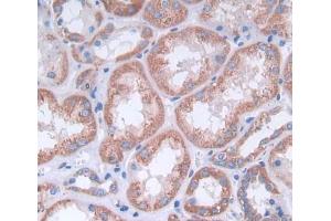 Used in DAB staining on fromalin fixed paraffin- embedded kidney tissue (alpha Adducin Antikörper  (AA 99-328))