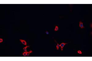 ABIN6266477 staining C1C12 cells by IF/ICC. (BAX Antikörper  (Internal Region))