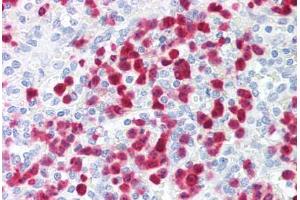 Human Spleen, Neutrophils (formalin-fixed, paraffin-embedded) stained with S100A8 antibody ABIN214203 at 2. (S100A8 Antikörper)