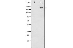 Western blot analysis of Tuberin/TSC2 expression in 293 whole cell lysates,The lane on the left is treated with the antigen-specific peptide.