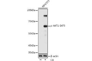 Western blot analysis of extracts of various cell lines, using Phospho--S473 pAb (ABIN1513328, ABIN5664973, ABIN5664975 and ABIN6225474) at 1:1000 dilution. (AKT1 Antikörper  (pSer473))