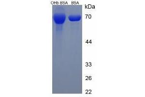 Image no. 1 for beta-hydroxybutyric Acid (BHBA) protein (BSA) (ABIN1880290) (BHBA Protein (BSA))