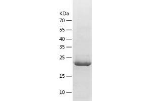 Western Blotting (WB) image for Leptin (LEP) (AA 428-635) protein (His tag) (ABIN7123743) (Leptin Protein (LEP) (AA 428-635) (His tag))
