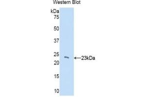 Detection of recombinant CBX3 using Polyclonal Antibody to Chromobox Homolog 3 (CBX3) (CBX3 Antikörper  (AA 1-183))