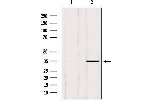 Western blot analysis of extracts from 293, using LDHB antibody. (LDHB Antikörper  (N-Term))