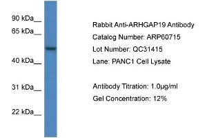 Western Blotting (WB) image for anti-rho GTPase Activating Protein 19 (ARHGAP19) (C-Term) antibody (ABIN2788550) (ARHGAP19 Antikörper  (C-Term))