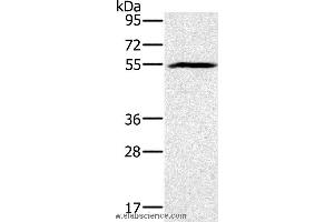 Western blot analysis of Mouse heart tissue, using BMP6 Polyclonal Antibody at dilution of 1:500 (BMP6 Antikörper)