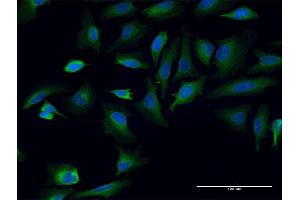 Immunofluorescence of monoclonal antibody to TPR on HeLa cell.