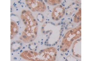Used in DAB staining on fromalin fixed paraffin- embedded Kidney tissue (POMP Antikörper  (AA 1-141))